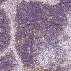 PRSS16 Antibody, Novus Biologicals 25 &mu;L; Unlabeled:Antibodies, Polyclonal